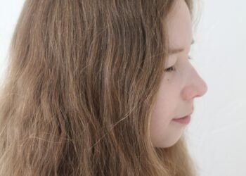 A Comprehensive Clinical Report on Adolescent Hair Loss: Causes, Diagnosis, and Pathways to Management