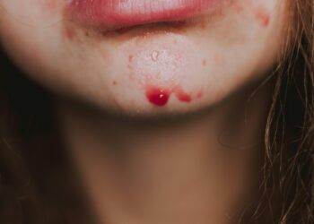 Bleeding After Sex? Your Body Isn’t Broken, It’s Sending You a Message