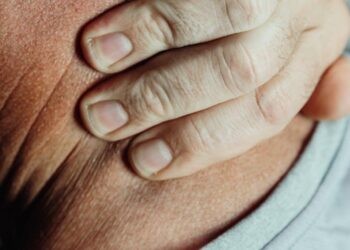 The Vise: My Journey Through the Grip of Jaw Clenching and How I Finally Found Release