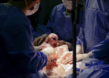 The Blueprint of a Miracle: Inside Kourtney Kardashian’s Fetal Surgery and the Story That Changed a Public Conversation