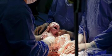 The Blueprint of a Miracle: Inside Kourtney Kardashian’s Fetal Surgery and the Story That Changed a Public Conversation